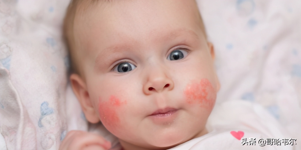 宝宝牛奶蛋白过敏可以喝羊奶粉吗,对牛奶过敏吃什么羊奶粉口碑最好