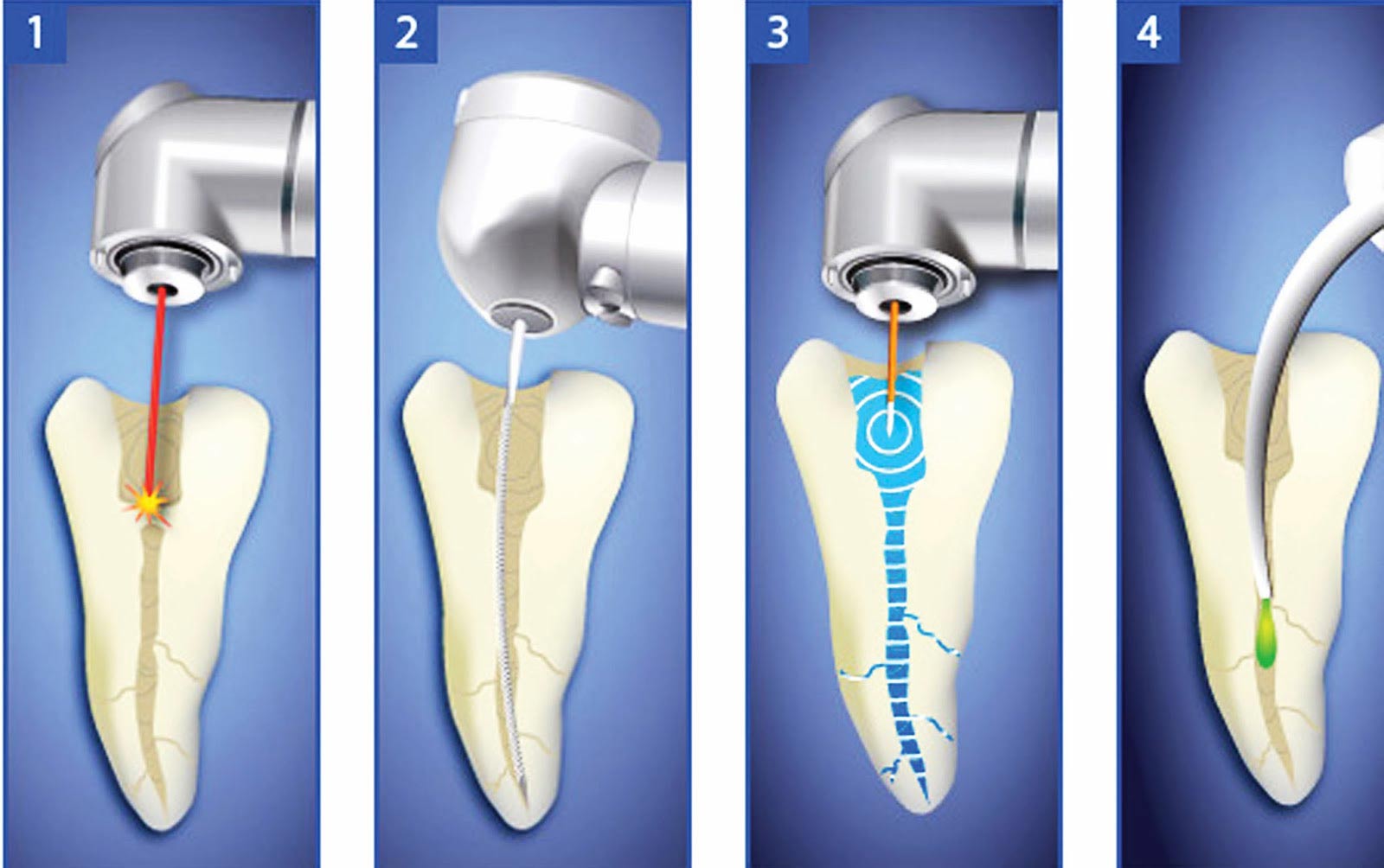 怎么判断自己是哪种牙痛,如何判断自己的牙痛属于哪种状况