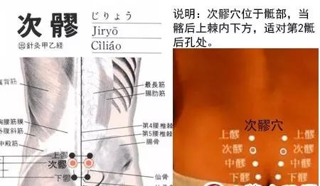 艾灸子宫穴后容易怀孕吗,艾灸暖宫有助于受孕