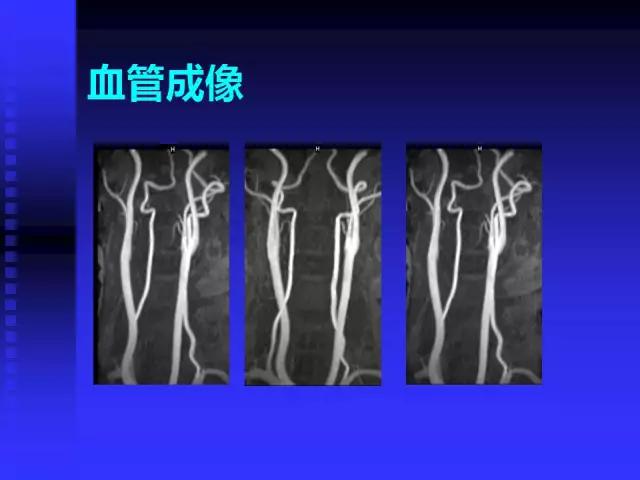 头颅mri读片视频教程,颅脑mri读片入门教程视频讲解全集