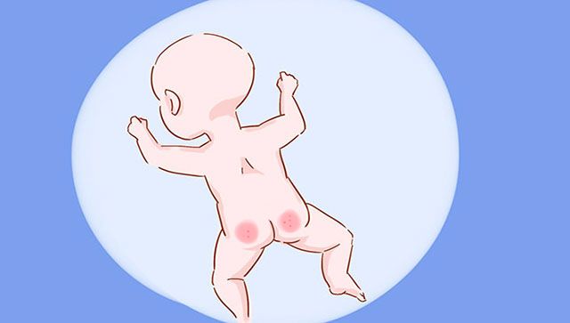 宝宝一尿就要换尿不湿吗,宝宝一尿就换纸尿裤