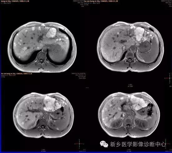 这些部位的黑色素瘤，您会诊断吗？