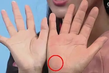 手上7个小细节竟然暗藏大健康,手诊10种常见病从手上就能看出来