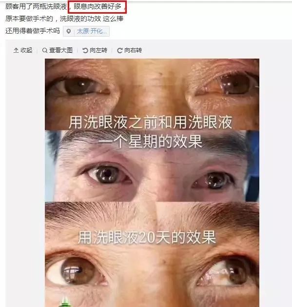 洗眼液什么情况不能用,洗眼液会不会有副作用