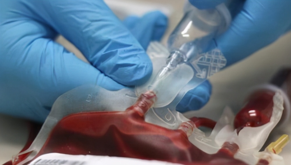 比熊猫眼还稀有的血型,世界上有比熊猫血还稀有的血型吗