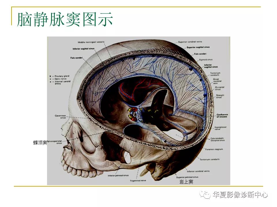 中国人脑立体定向mri应用解剖图谱,脑mri示意图