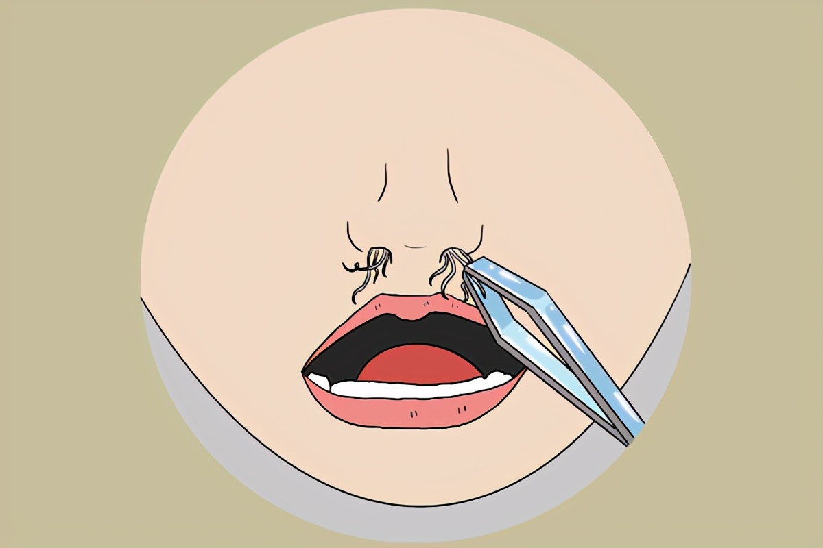 鼻毛变白是衰老的前兆吗,鼻毛变白是什么原因导致的