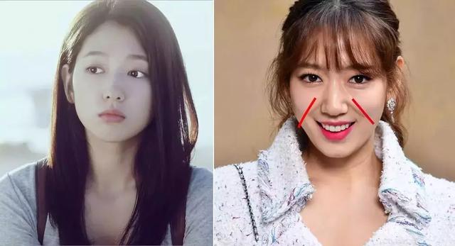 硬刚女皇龙妈也扛不住法令纹，2条沟壑让人心疼，贴一贴就消了