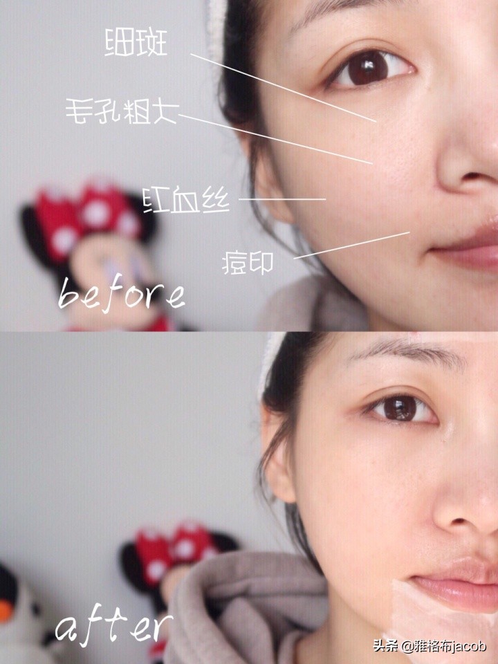 红腰子精华和sk2神仙水哪个好用,sk2神仙水哪个套餐好用