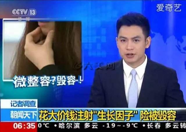 张歆艺用的什么填充脸部,张歆艺填充脸部前后对比