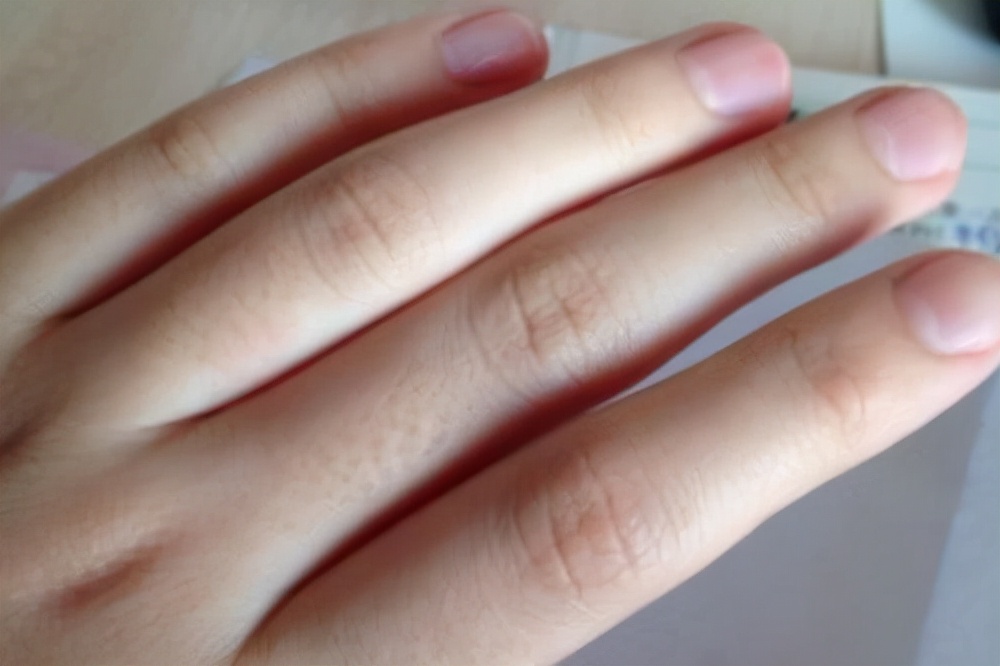 女人气血不足怎么补气血最快,女人气血不足怎么办快速补气血