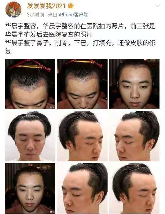 张碧晨说华晨宇真实人品,华晨宇张碧晨2017年绯闻照片