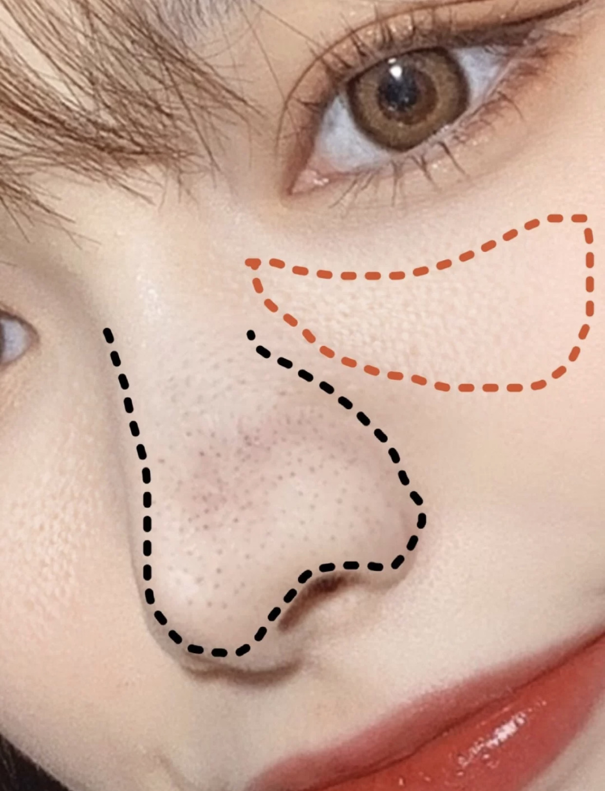 去黑头的几大“雷品”！城野医生用处不大，黑炭硬撕你敢用？