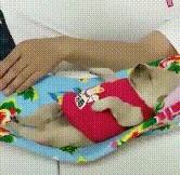 如被猫狗咬伤或抓伤应如何处理,被猫狗咬伤在多少小时之内打疫苗