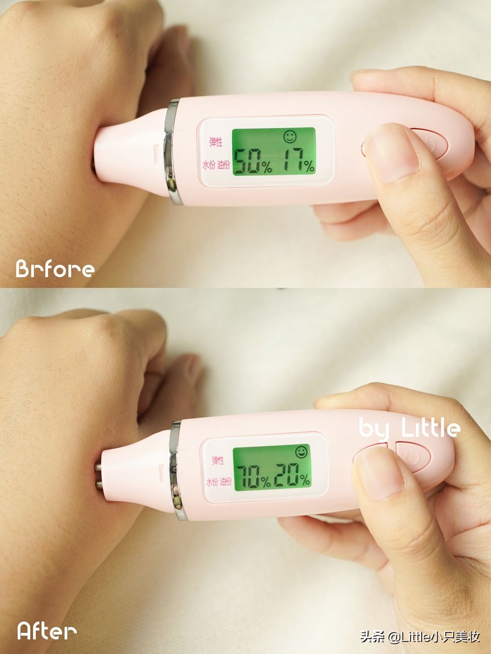 简单几招让你迅速解决粗大毛孔,改善毛孔粗大最有效的办法测评