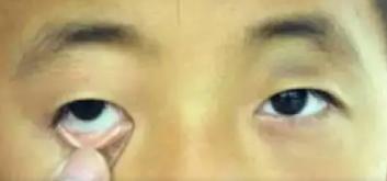 贫血吃什么食物补血最快孕妇,贫血吃什么食物补血最快最好呢