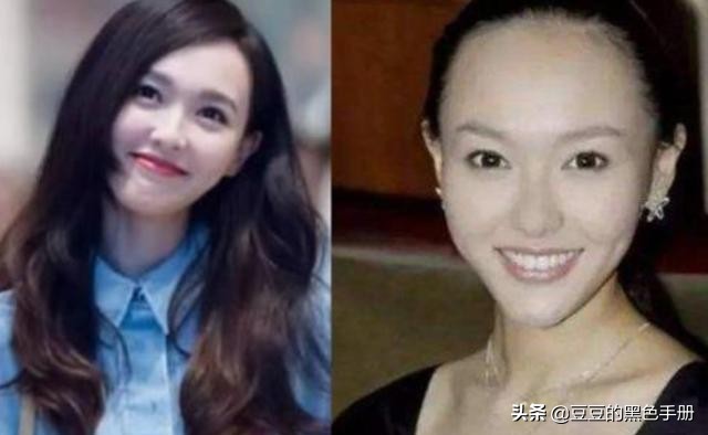 脑门大发际线高的女明星,大脸大脑门秃头女生适合的发型