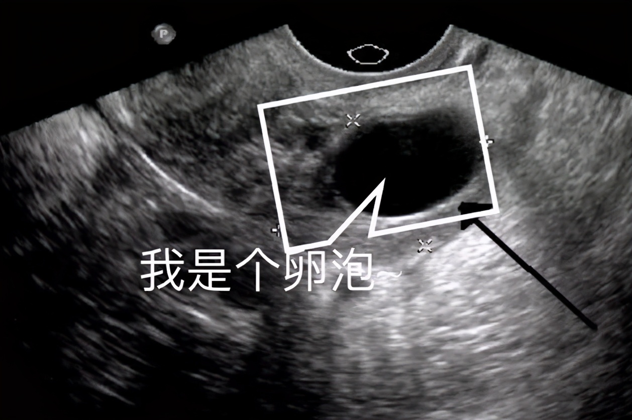 囊肿脓与淋巴脓的区别,液囊跟囊肿有什么区别