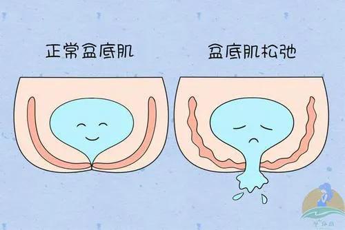 哪些人适合穿塑身衣,长期穿塑身衣对女性导致哪些危害