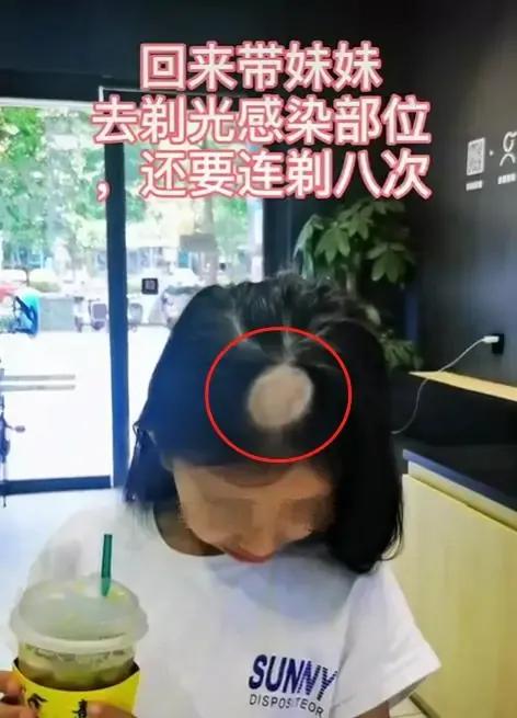 十年老猫舍深谈，如何发现，应对，治疗《猫藓》