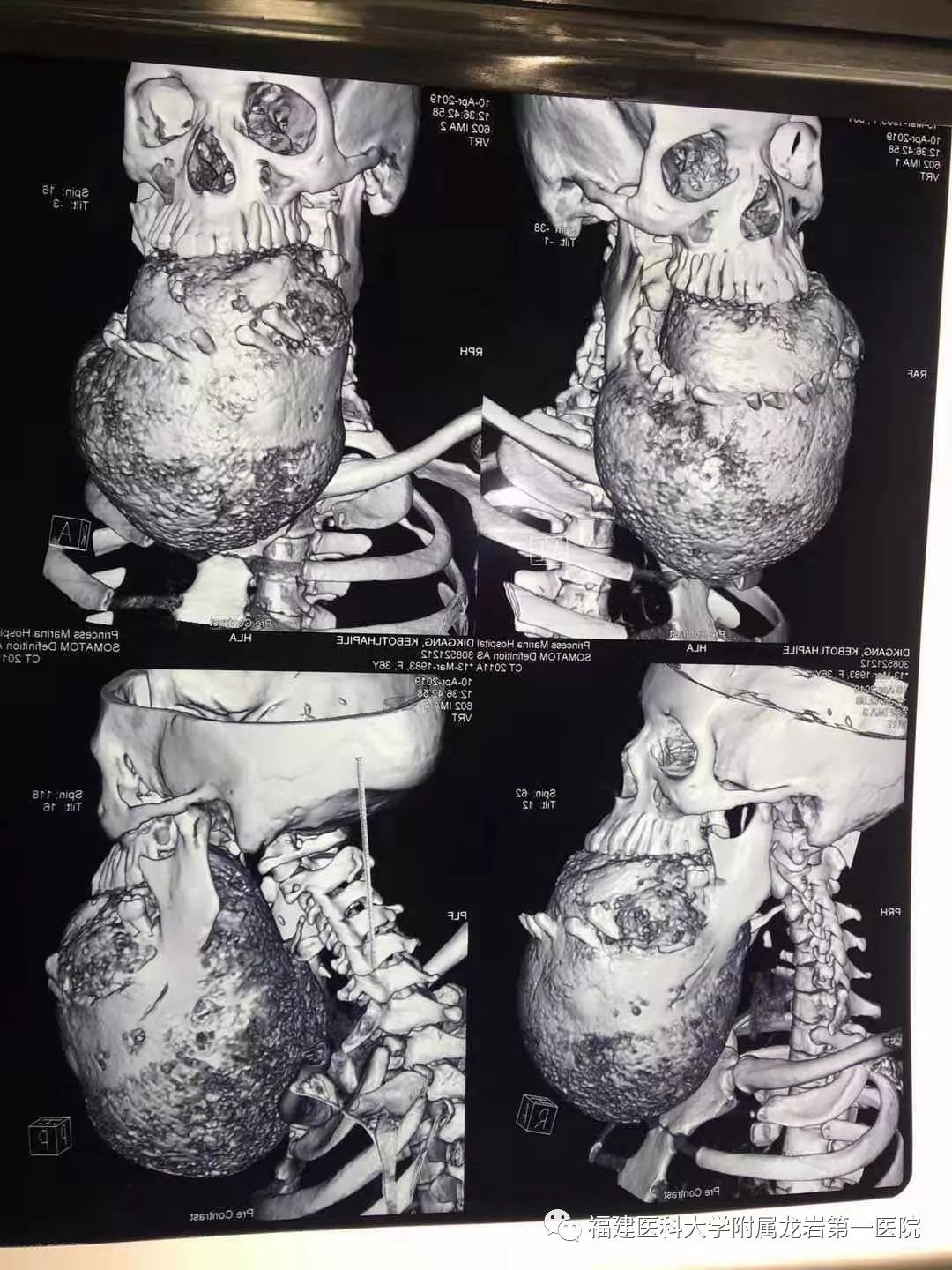 龙岩第一医院：医道*界无**，远赴非洲，让胸前的五星红旗更加闪耀