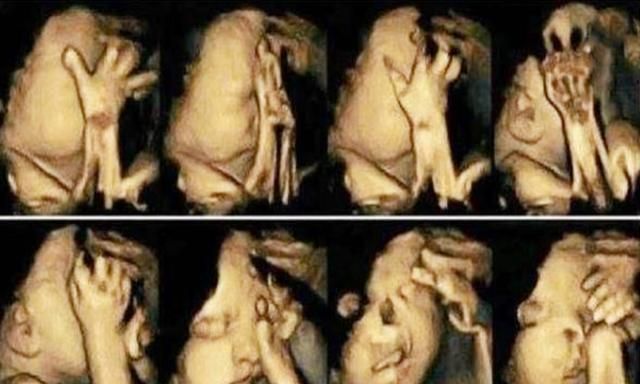 孕六个月四维胎儿做了个鬼脸,四维彩超胎儿做鬼脸