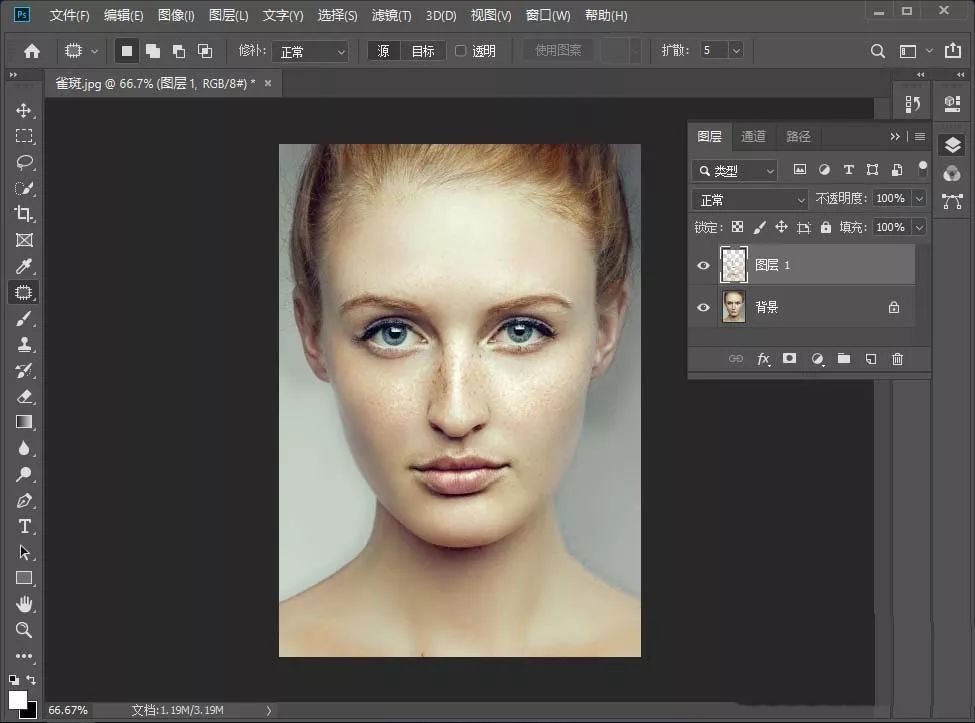 祛除脸部雀斑最有效的方法,有什么日常方法可以去除脸上雀斑