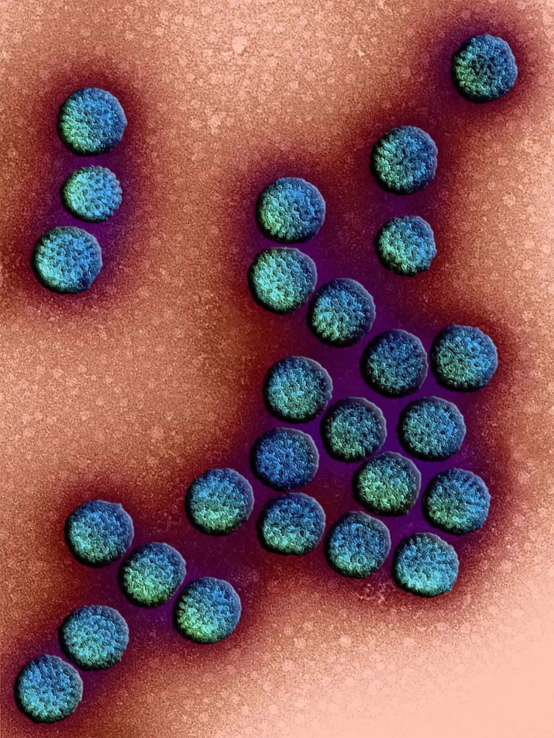 感染病毒后的168小时，你的体内都发生了什么？