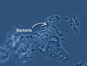 内裤裤子老是黄是什么原因,裤子下面总是黄黄的是怎么回事