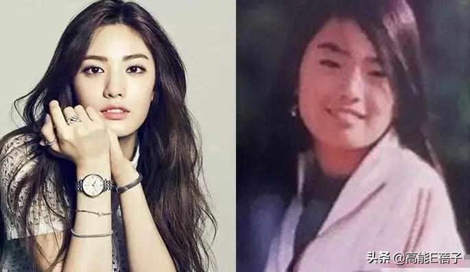 微整形需要多久,最受欢迎的5大微整形