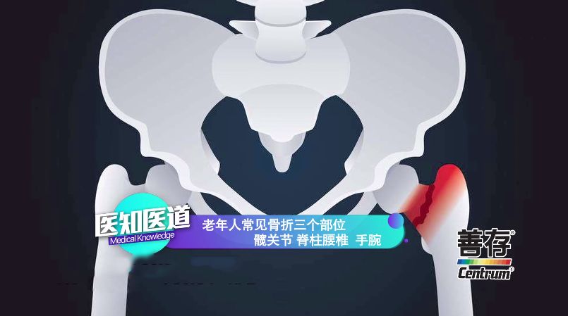 雪天路滑冬季老年人如何防跌倒,老人跌倒应该得到怎样的及时帮助