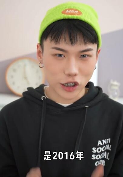 美妆网红晒华晨宇变脸过程质疑其做了3项整容手术，真的不怕被告