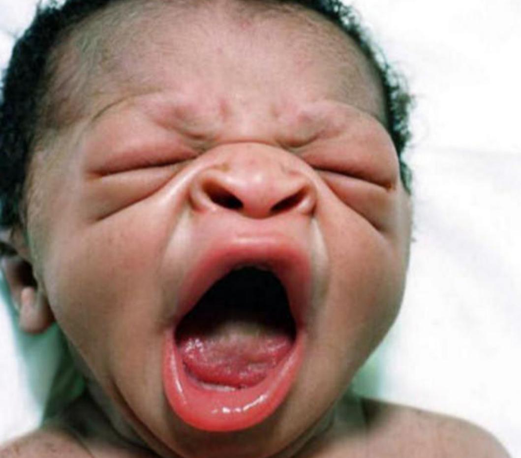 刚出生的婴儿好看为什么越来越丑,新生儿宝宝丑图