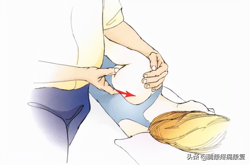 背阔肌综合征病历,背阔综合症