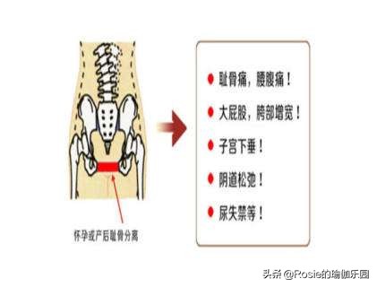 产后各种痛,产后骨盆自我修复