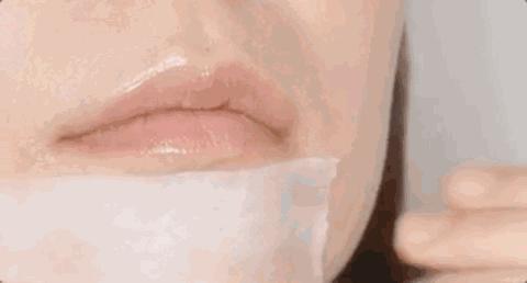 黑头闭口连根拔起,黑头粉刺连根拔起留坑