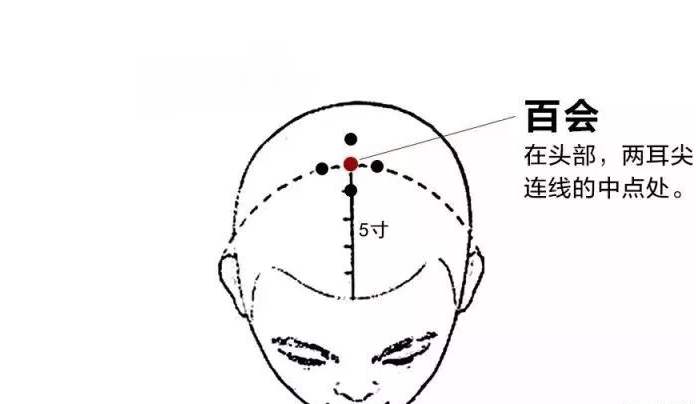 子宫脱垂产后一年还能治疗,产后子宫脱垂怎么治疗最好