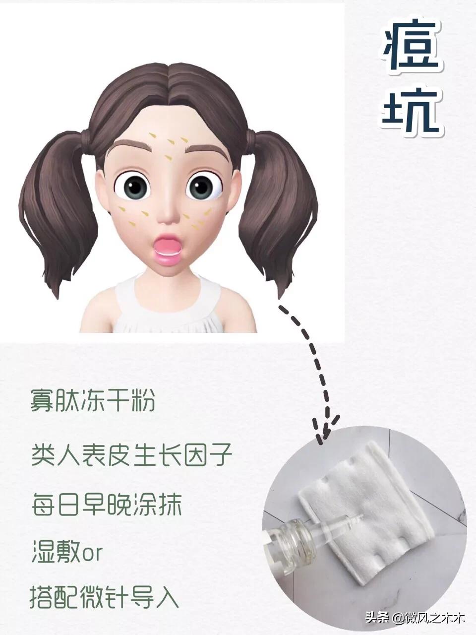 痘印痘坑消除要做多少次医美,去痘印痘坑痘疤的医美方法