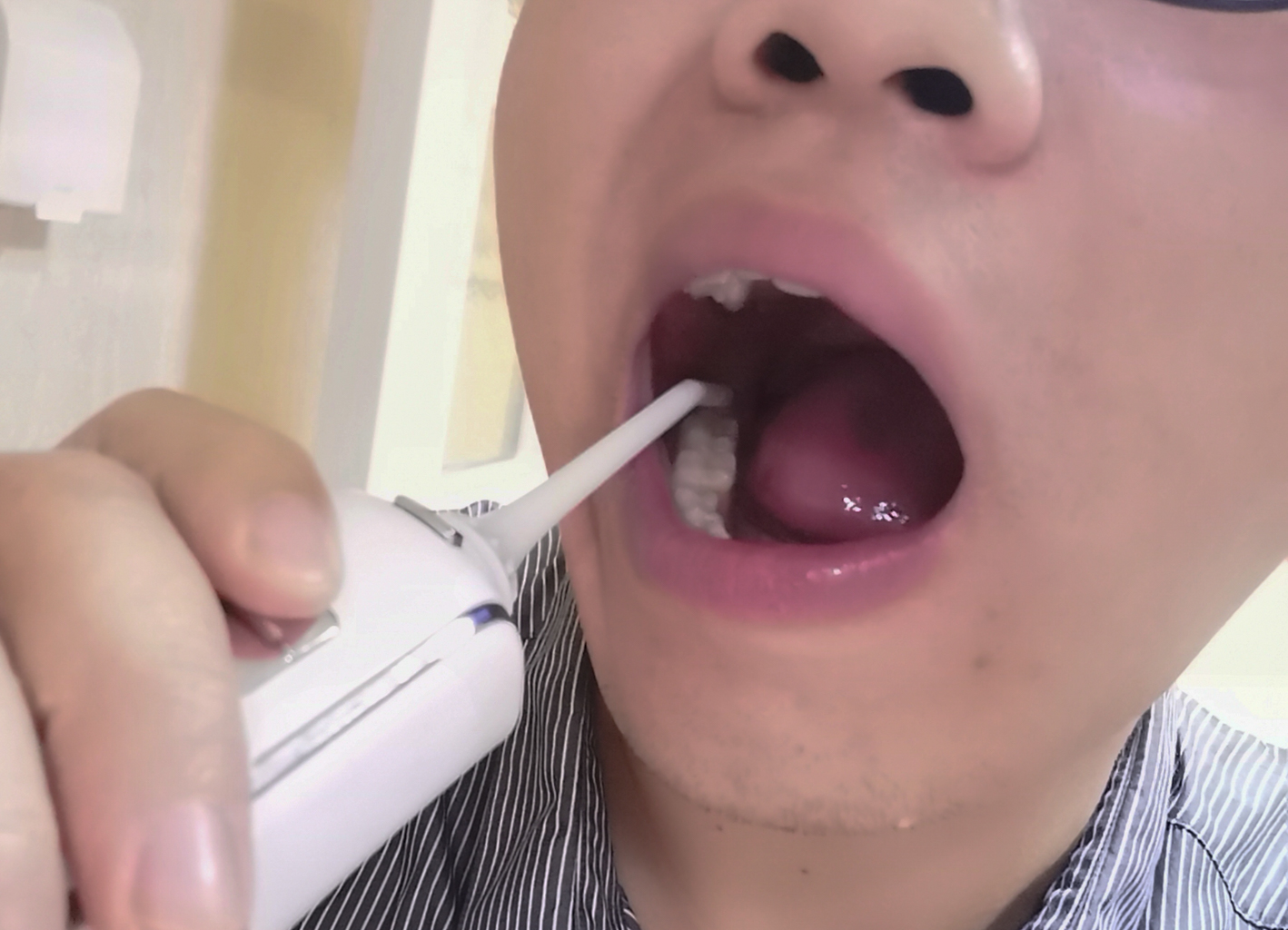 心诺洗牙器参数,美国心诺洗牙器评测