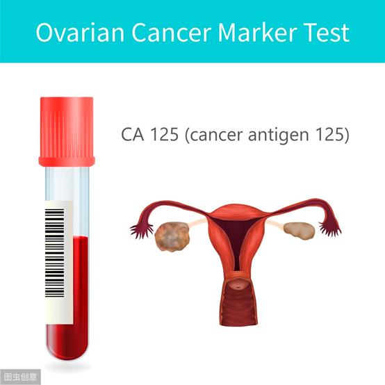 皮肌炎合并卵巢癌晚期怎么治疗,奥拉帕利治疗卵巢癌晚期效果好吗