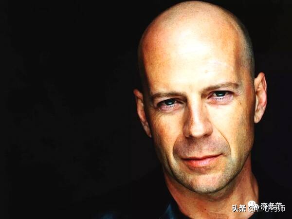 脱发真的没有治疗的方法吗,脱发严重真的没救了吗