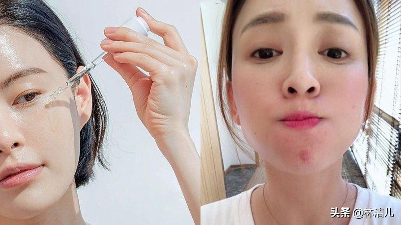 刘雨昕怕长痘吗,刘雨昕长痘的原因