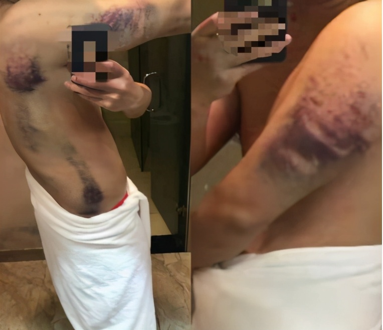 【关注】皮鞭、木棍、水牢……揭秘缅北的“发财梦”！