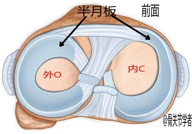 膝关节磁共振如何识别半月板损伤,磁共振半月板越来越严重怎么回事