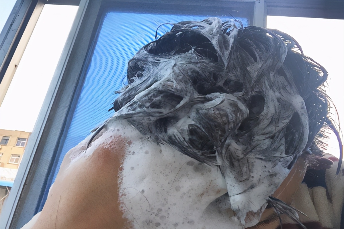 脖子和头皮上长疙瘩发痒怎么回事,老人头皮发痒起小疙瘩是什么原因