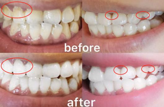濂冲＋鍙ｈ厰棣欐按鎸佷箙鐣欓,濂介椈鍙ｈ厰鍠烽浘棣欐按