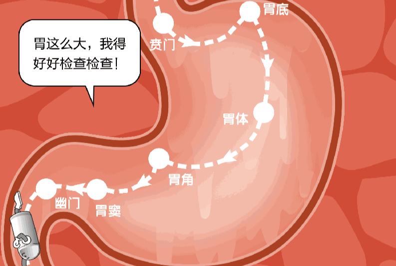 胶囊机器人胃镜设备多少钱,我国5g胃镜胶囊机器人视频