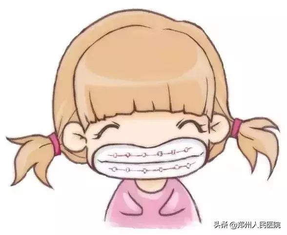 牙箍什么时候戴合适,14岁戴牙箍要戴多久