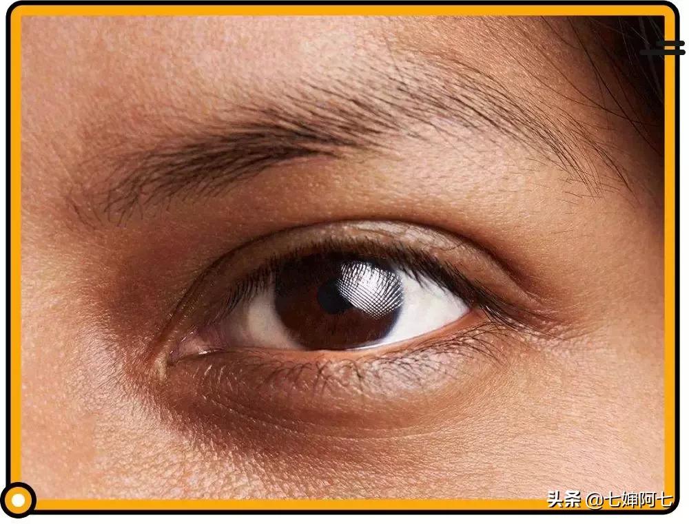 长久都无法消除的黑眼圈,顽固性的黑眼圈要怎么去