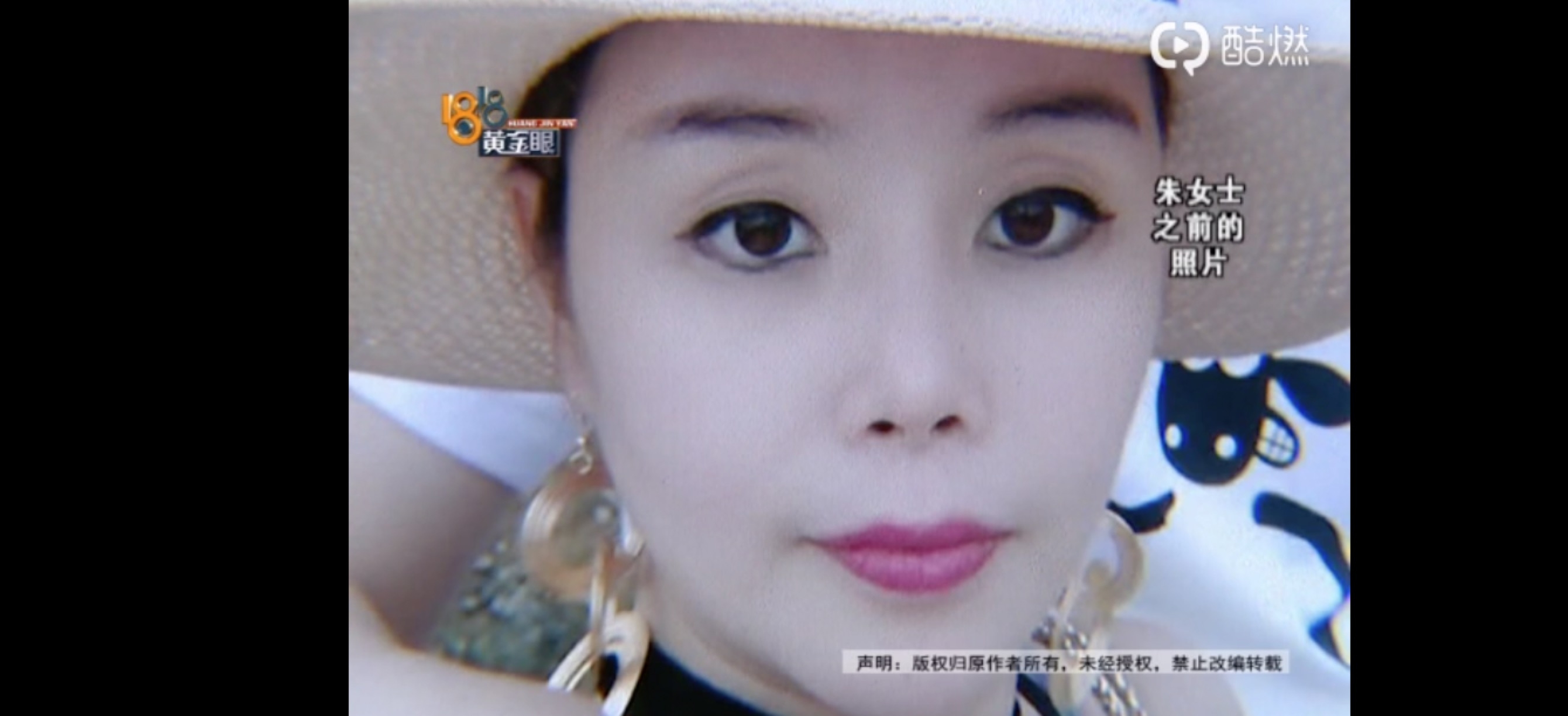 离婚女子为嫁人整容却被毁容,离婚的女人因整容失败想复婚